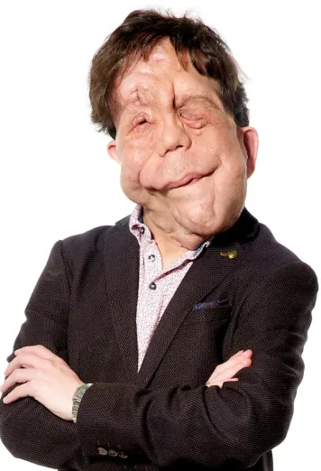 Adam Pearson